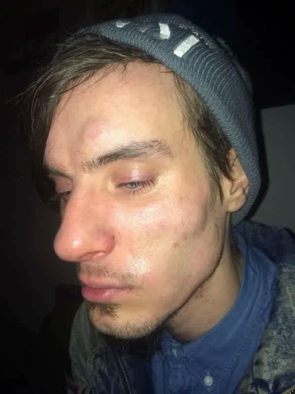 Gruppo di attivisti antirazzisti e LGBT aggrediti dai sostenitori di Trump - 15541487 1400334583330603 5703133549513328013 n - Gay.it