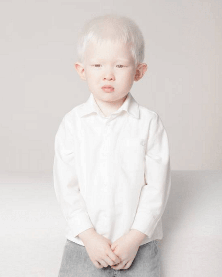 Tutti i colori del bianco: il progetto fotografico sulle persone albine
