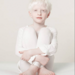 Tutti i colori del bianco: il progetto fotografico sulle persone albine - Thumbnail