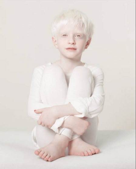 Tutti i colori del bianco: il progetto fotografico sulle persone albine