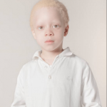 Tutti i colori del bianco: il progetto fotografico sulle persone albine - Thumbnail