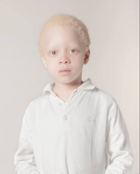 Tutti i colori del bianco: il progetto fotografico sulle persone albine