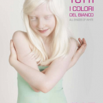 Tutti i colori del bianco: il progetto fotografico sulle persone albine - Thumbnail