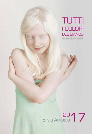 Tutti i colori del bianco: il progetto fotografico sulle persone albine