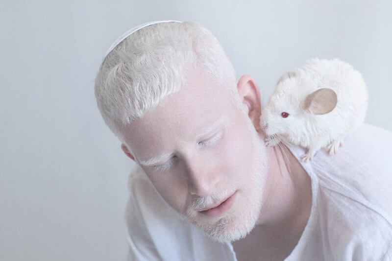 Tutti i colori del bianco: il progetto fotografico sulle persone albine - albini - Gay.it