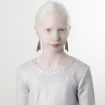 Tutti i colori del bianco: il progetto fotografico sulle persone albine - Thumbnail