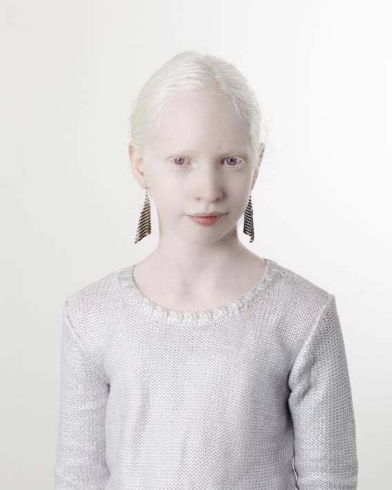 Tutti i colori del bianco: il progetto fotografico sulle persone albine