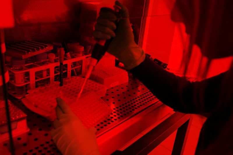 HIV in Italia: almeno 30mila persone sono sieropositive ma non lo sanno