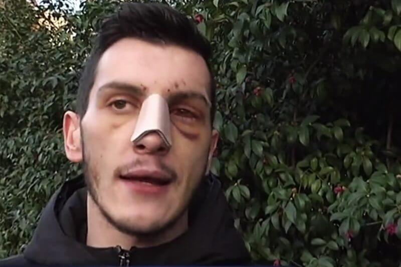 Parla Michele, uno dei due ragazzi pestati a Milano dagli omofobi
