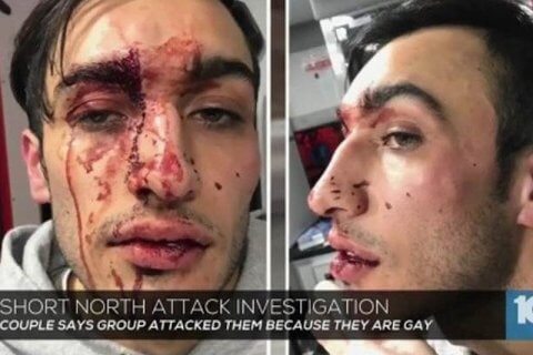 Vile aggressione in Ohio a danno di una coppia gay - Columbus Ohio attack - Gay.it