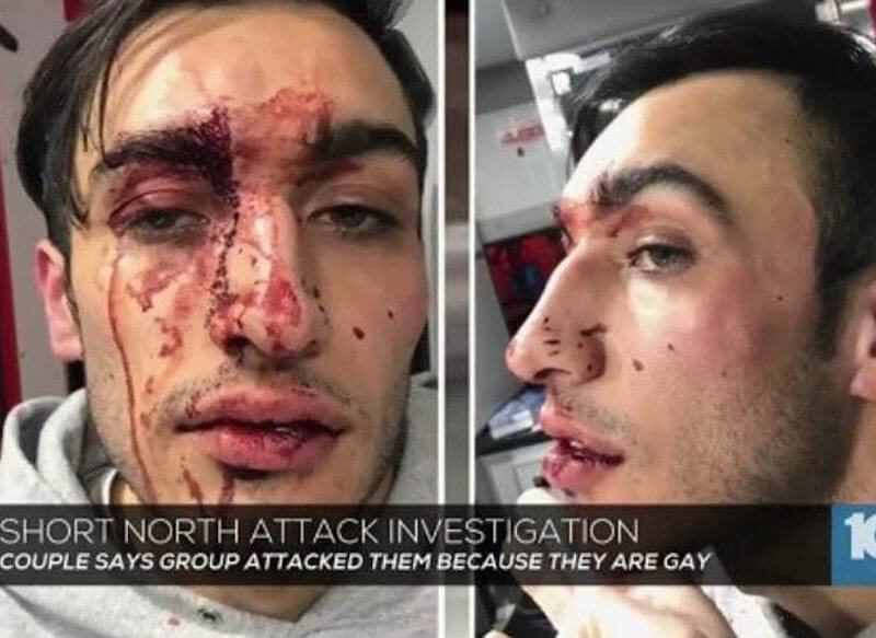Vile aggressione in Ohio a danno di una coppia gay