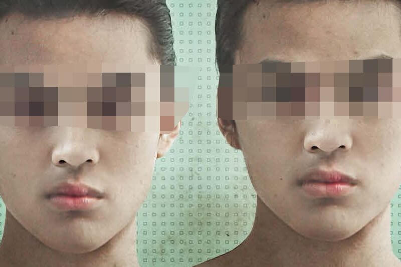 La Malesia invita i gay a curare la propria omosessualità con il digiuno
