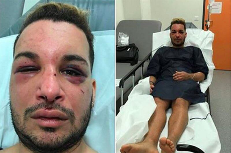 Francia: attivista gay picchiato, imprigionato e violentato per giorni
