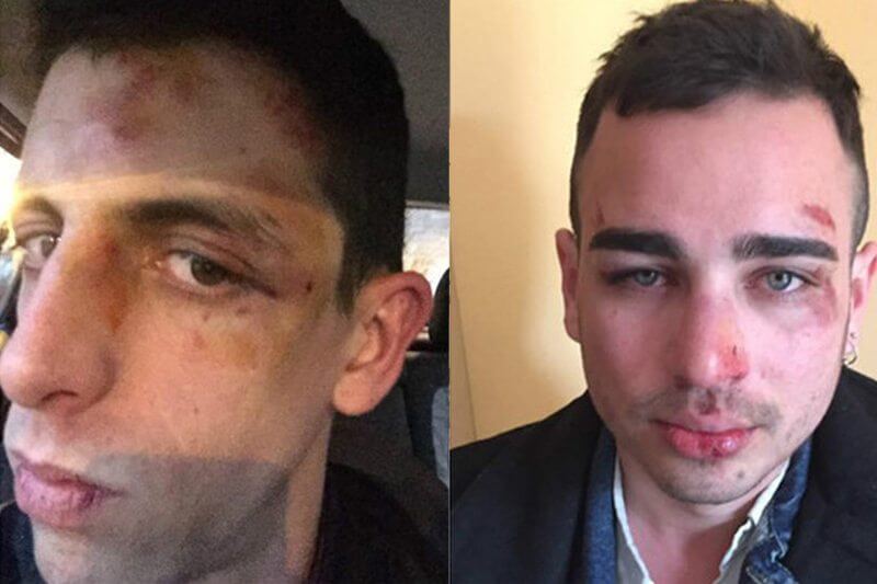 Coppia gay massacrata di botte per un bacio