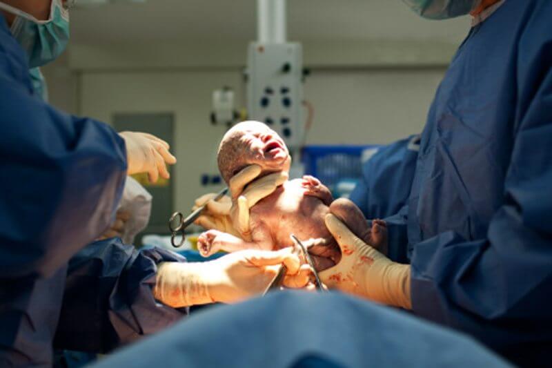 Trapianto dell’utero: “Tra 10 anni anche i maschi potranno partorire”