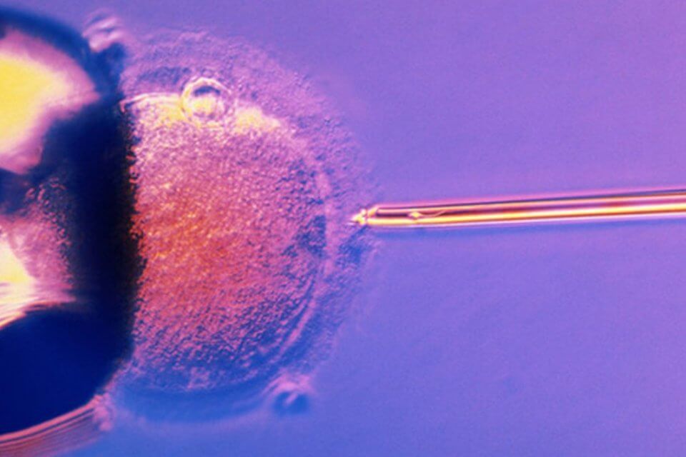 fecondazione in vitro