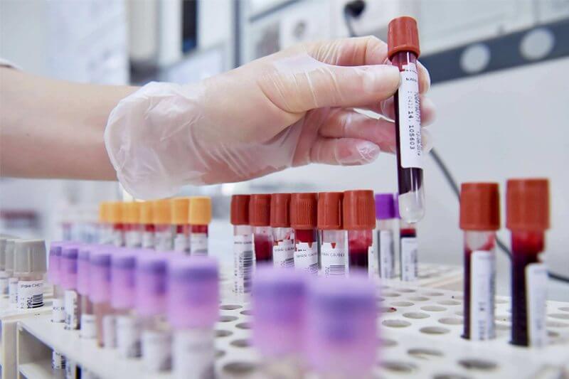 Milano è la capitale italiana dell’HIV: record di contagi