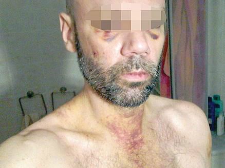 Genova, lo picchiarono perché ritenuto gay: arrivano gli sconti di pena - genova 2 - Gay.it