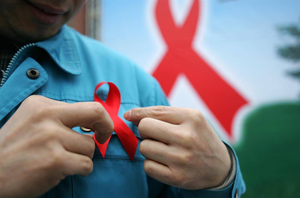 World Aids Day 2017, le iniziative di Arcigay per il primo dicembre - aids 2 - Gay.it