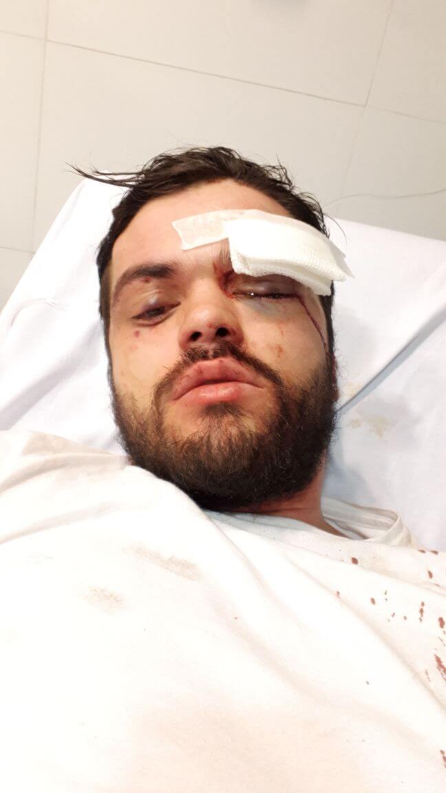 Pestato a sangue da 7 omofobi perché gay - le foto - DP LAGZX0AAjP4p - Gay.it
