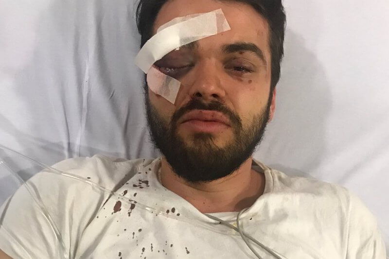 Pestato a sangue da 7 omofobi perché gay – le foto