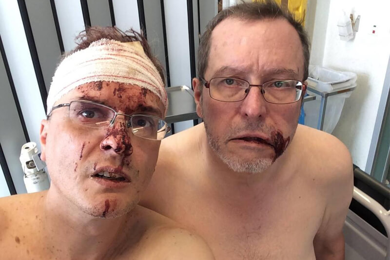 Omofobia: fumettista italiano e marito pestati a sangue in Belgio dai vicini di casa