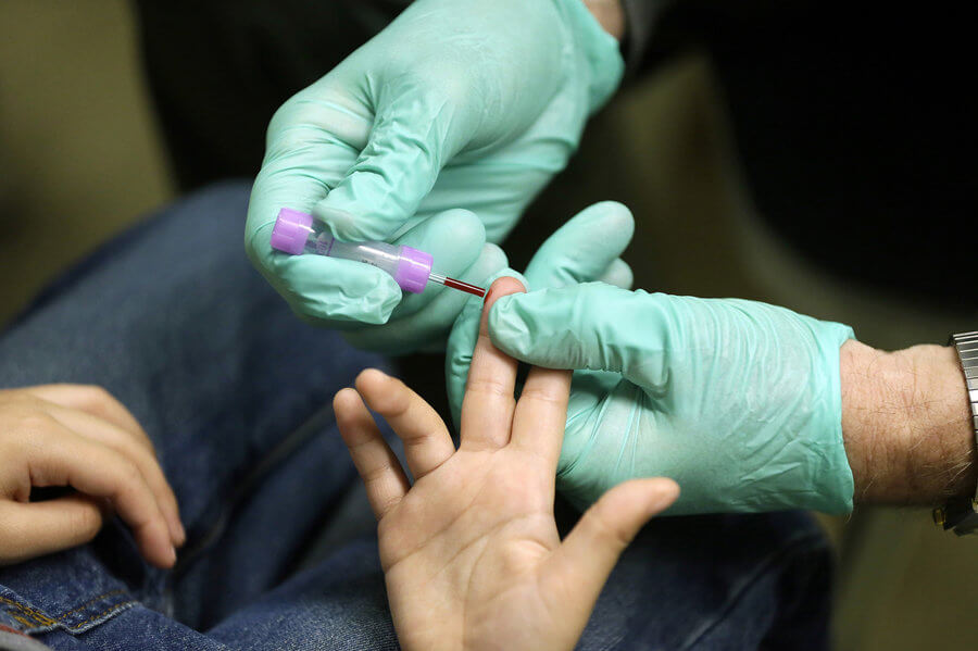 Le 10 cose da sapere su HIV e AIDS: scoprile con il test della settimana