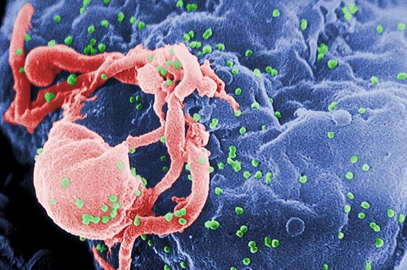 Le 10 cose da sapere su HIV e AIDS: scoprile con il test della settimana - virus - Gay.it