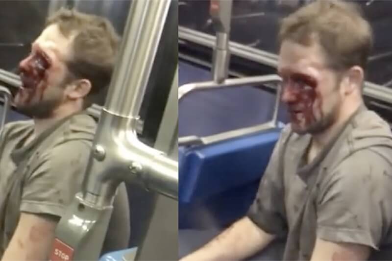 Omofobo insulta e aggredisce un ragazzo gay sul bus ma ha la peggio – il video