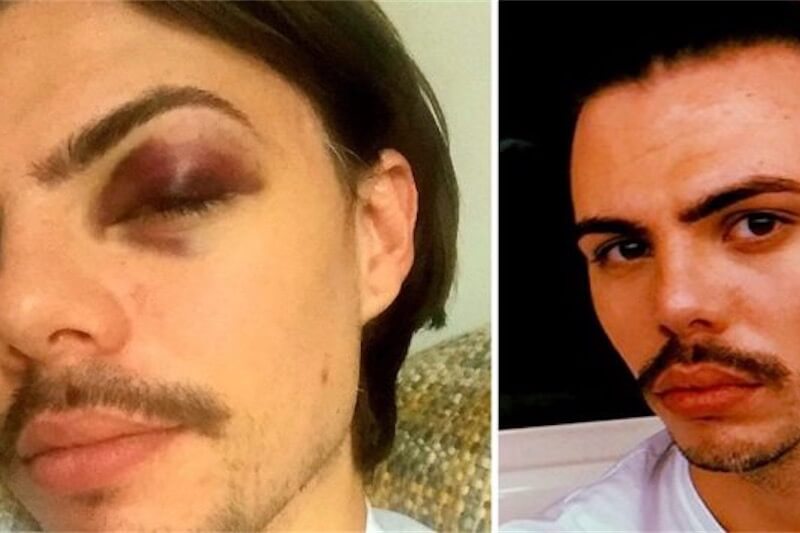 Tom Payne, youtuber picchiato perché gay