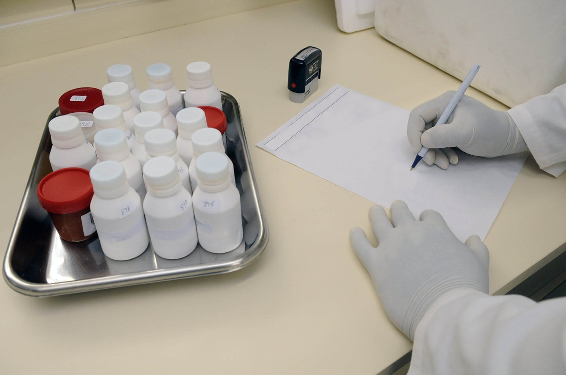 La parola all'esperto: HIV e AIDS, due mali ancora poco conosciuti - aids - Gay.it