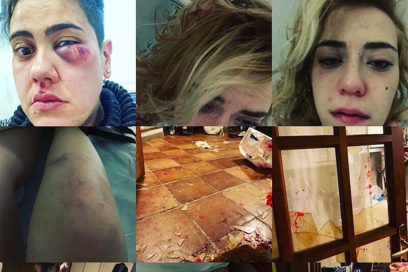Bolsena, inseguite e picchiate al grido ‘morite lesbiche’ – le foto