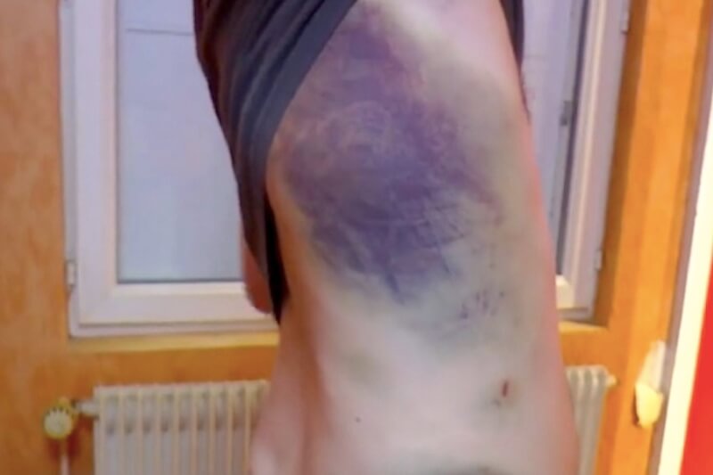 Francia, ragazzo torturato per due ore perché gay - francia - Gay.it