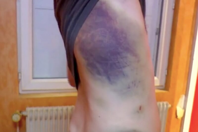 Francia, ragazzo torturato per due ore perché gay