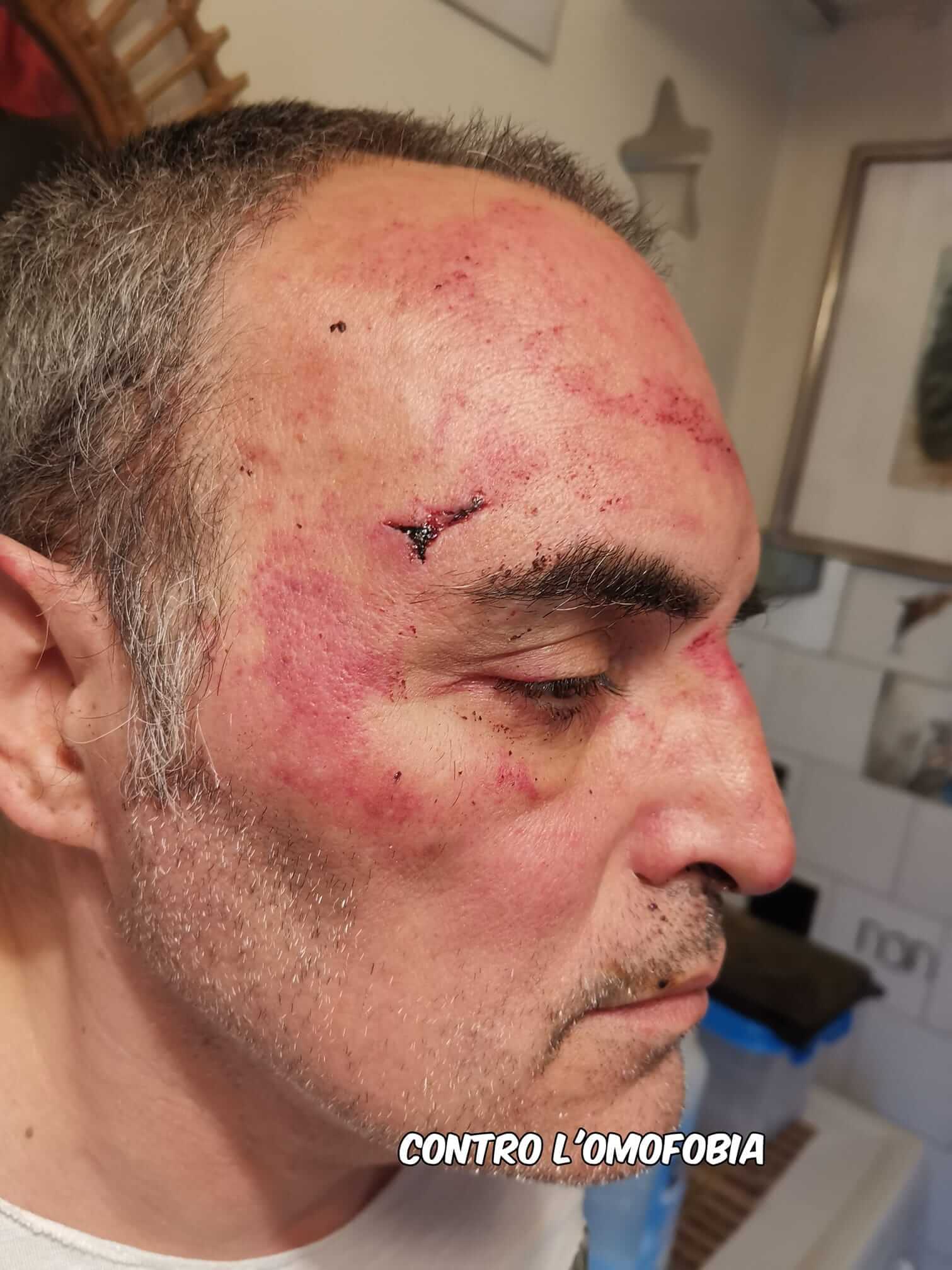 Torino, pestato a sangue al grido “brutto ricchi0ne, ti ammazziamo” - 49938631 346081682893005 3030895087199453184 o - Gay.it