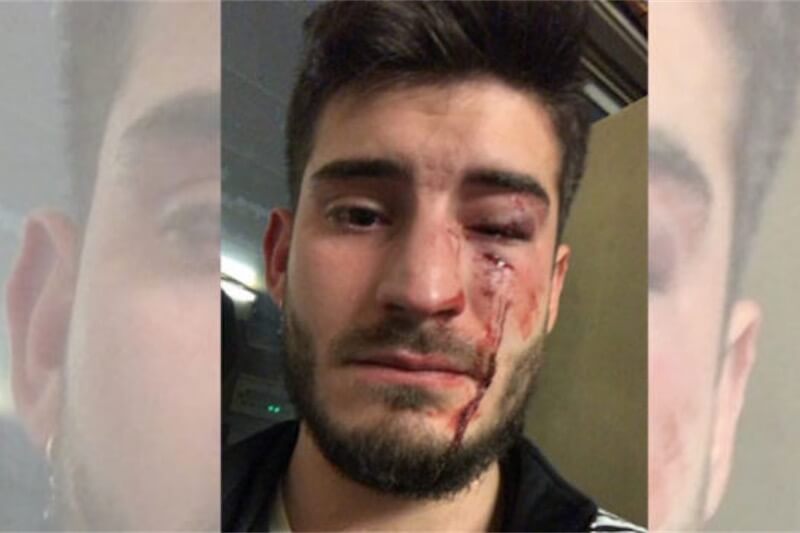 Barcellona, pestato a sangue in metro perché gay: due arresti