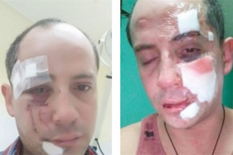 Cile, duplice scioccante aggressione omofoba
