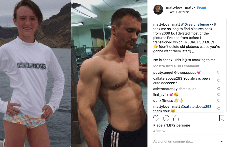 La transizione delle persone trans con #10yearschallenge