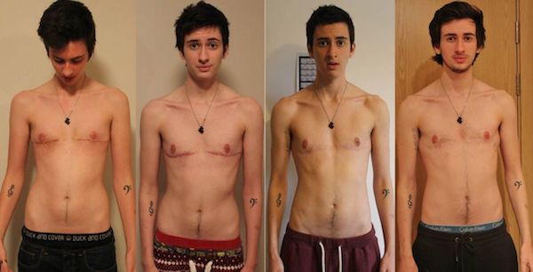 Disforia di genere e mondo T: metti alla prova le tue conoscenze con questo test - 2 - Gay.it