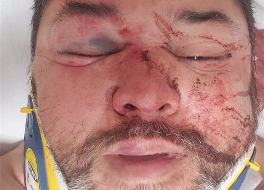 Massacrato di botte da 10 persone perché gay