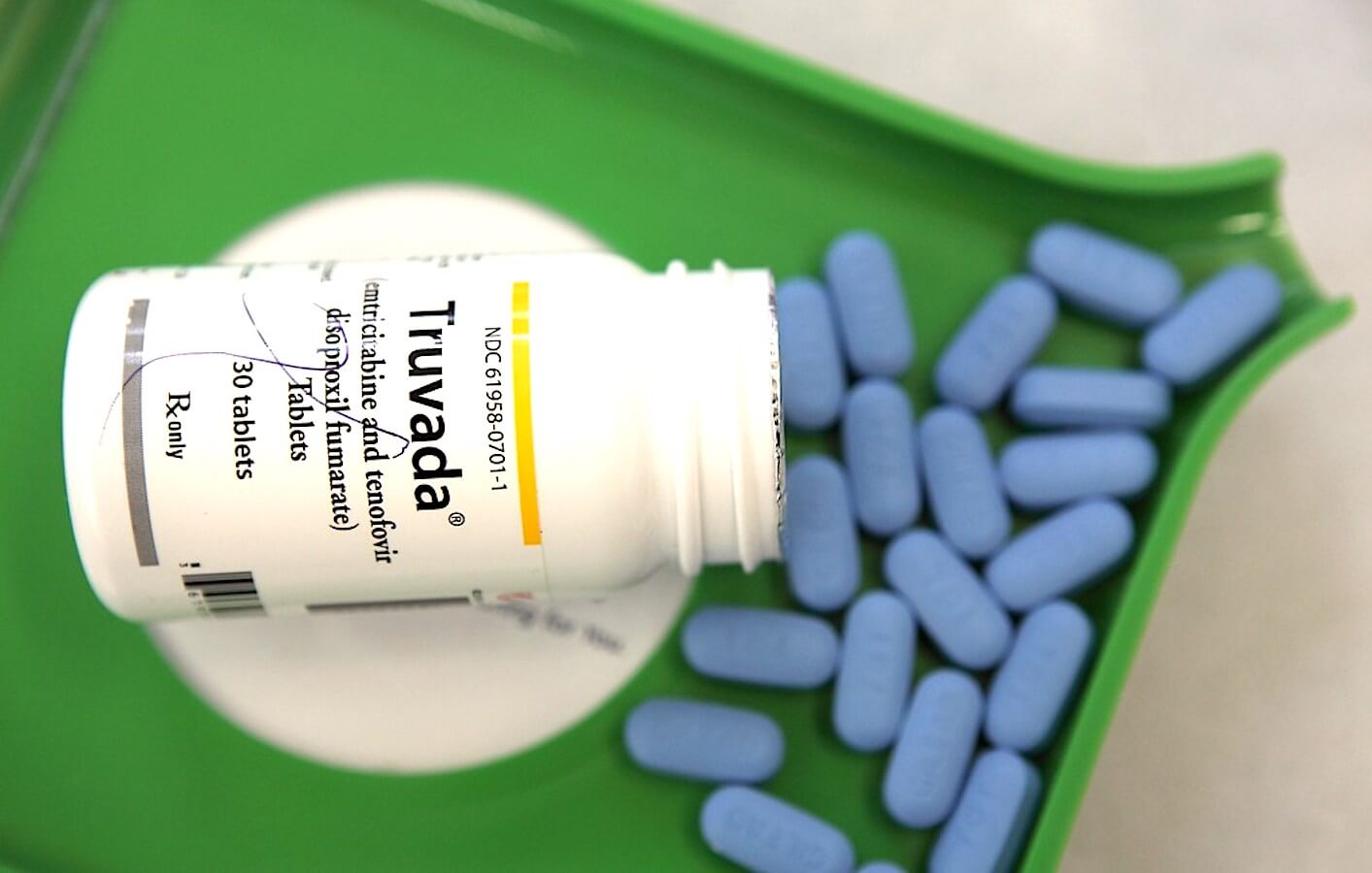 Ok a prevenzione dell’HIV con la PrEP: storica decisione in Cina