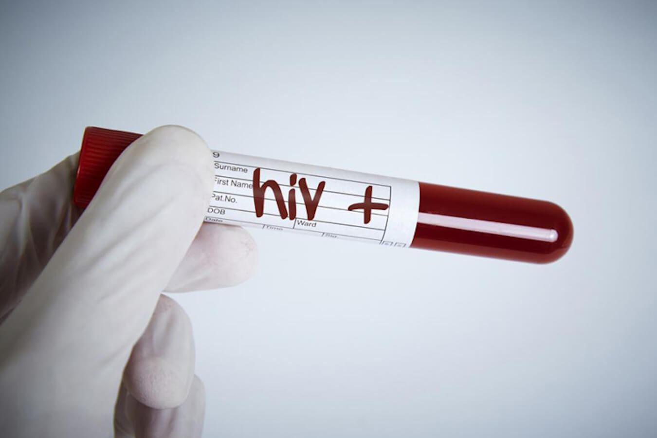 PrEP: arriva una nuova terapia dalla durata di un anno