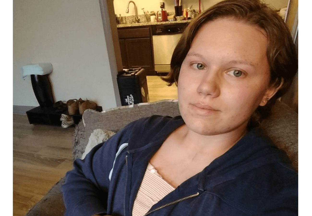 Transgender FTM cacciato dalla propria scuola dopo intervento di mastectomia