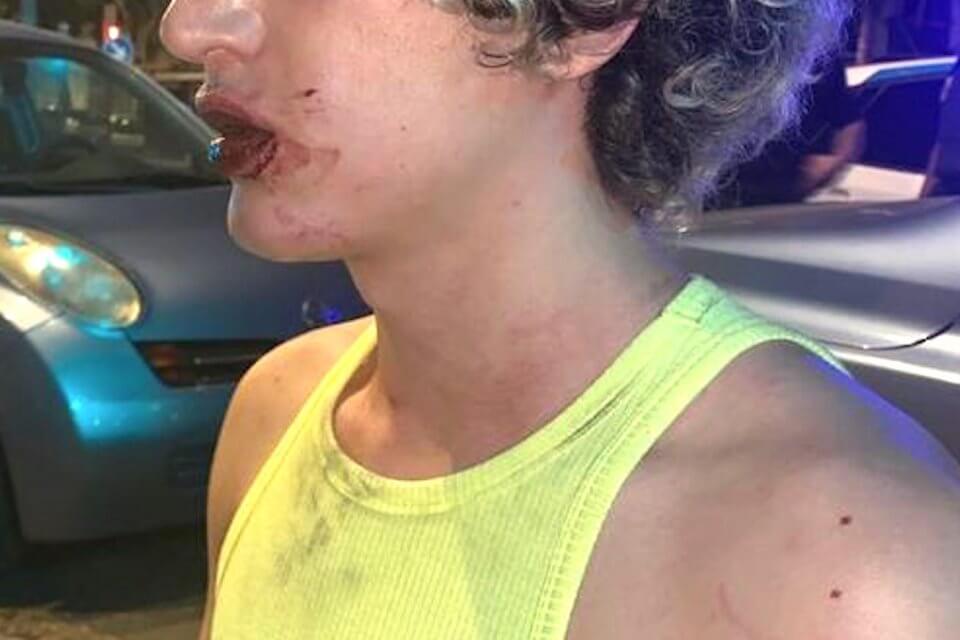 Valencia, due ragazzi italiani brutalmente aggrediti perché gay – VIDEO