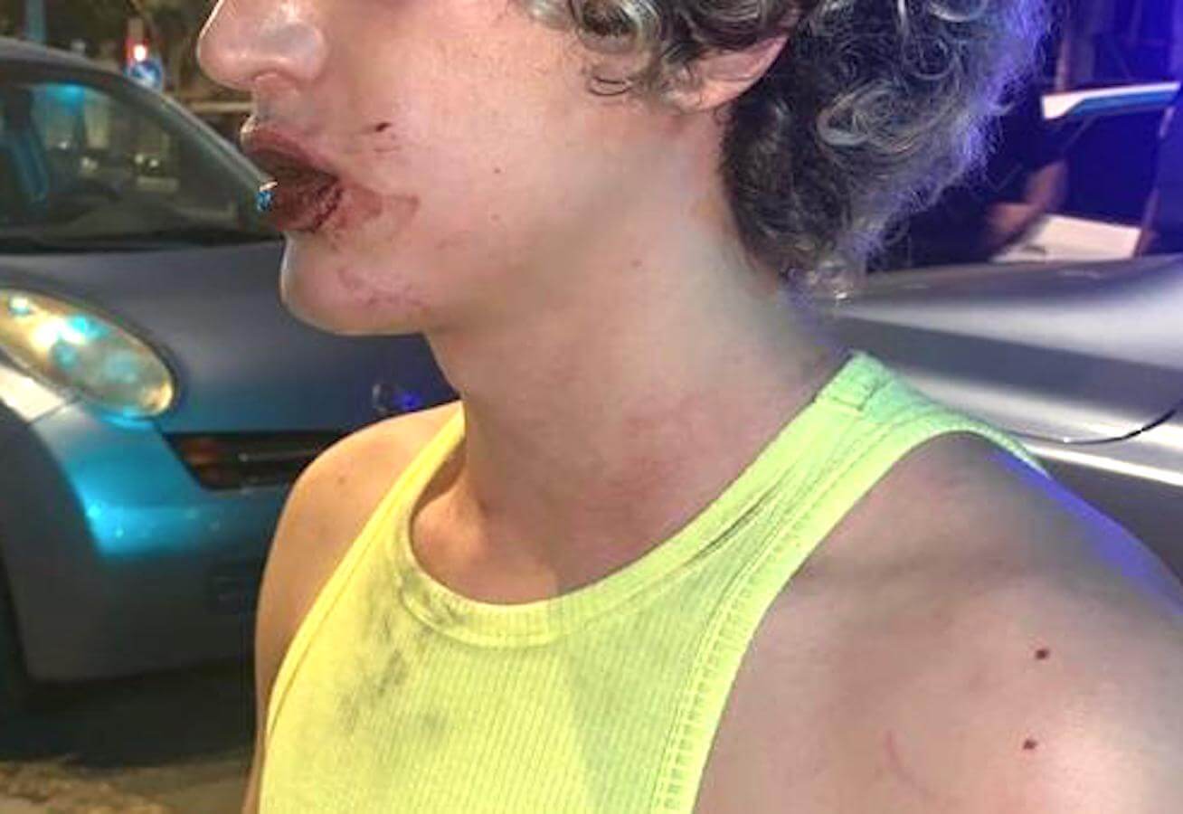 Valencia, due ragazzi italiani brutalmente aggrediti perché gay – VIDEO