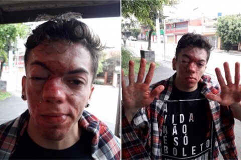 Bacia un altro ragazzo, pestato a sangue dall'autista del bus - Marcello Santanna - Gay.it