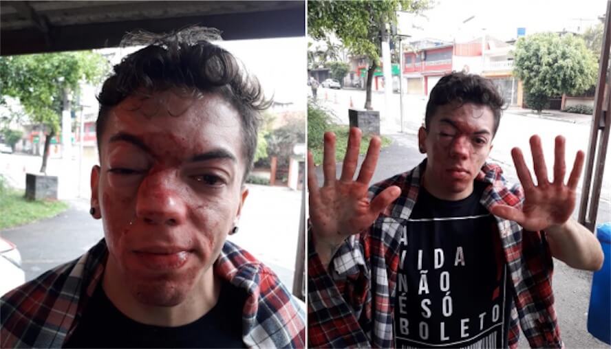 Bacia un altro ragazzo, pestato a sangue dall’autista del bus