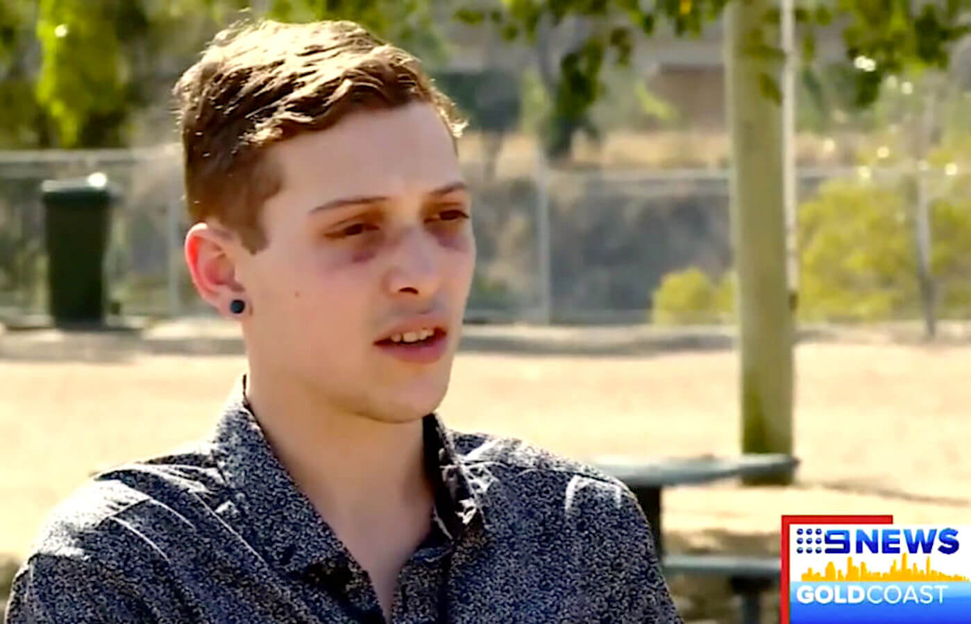 Ragazzo gay e fratello aggrediti dal branco: ‘sembrava ci stessero dando la caccia’