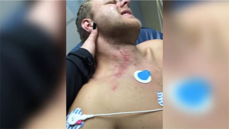 Fingono di essere poliziotti e aggrediscono una coppia gay – video