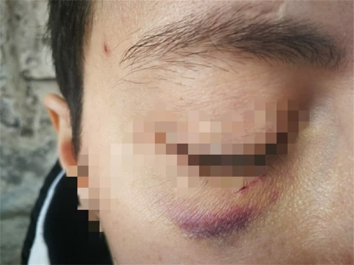 Bari, padre prende a calci e pugni figlia lesbica e la minaccia: “Ti ammazzo”